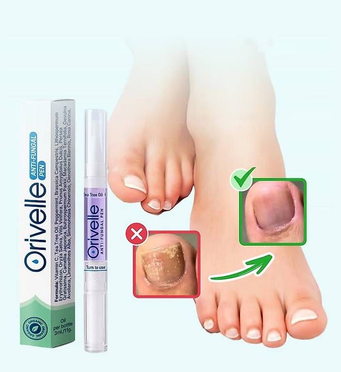 Pedicure: Orivelle Nagelpilzpen – Usato da bern venduto da jeannie2006 2