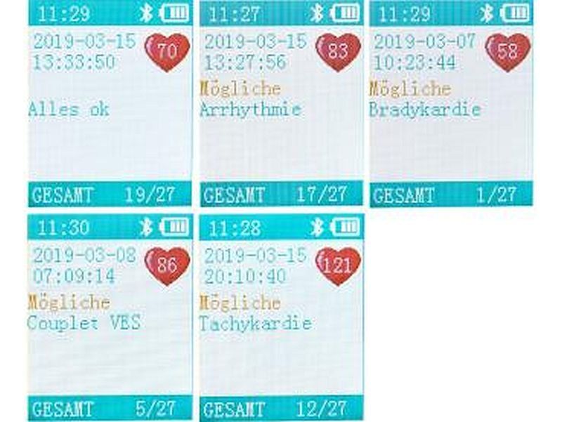 EKG Messschieber Blau - Medizinisches Messwerkzeug Für Ärzte